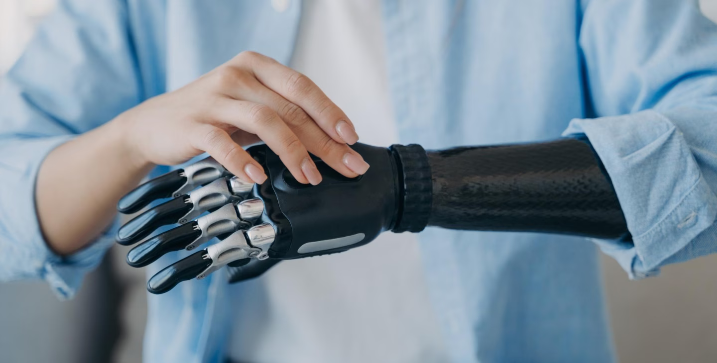 Main humaine interagissant avec une prothèse robotisée illustrant la gestion des ancillaires et des équipements techniques.
